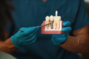 affordable dental implants