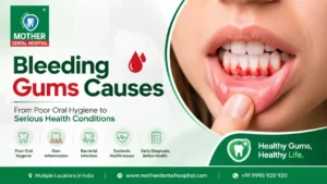 Bleeding Gums Causes