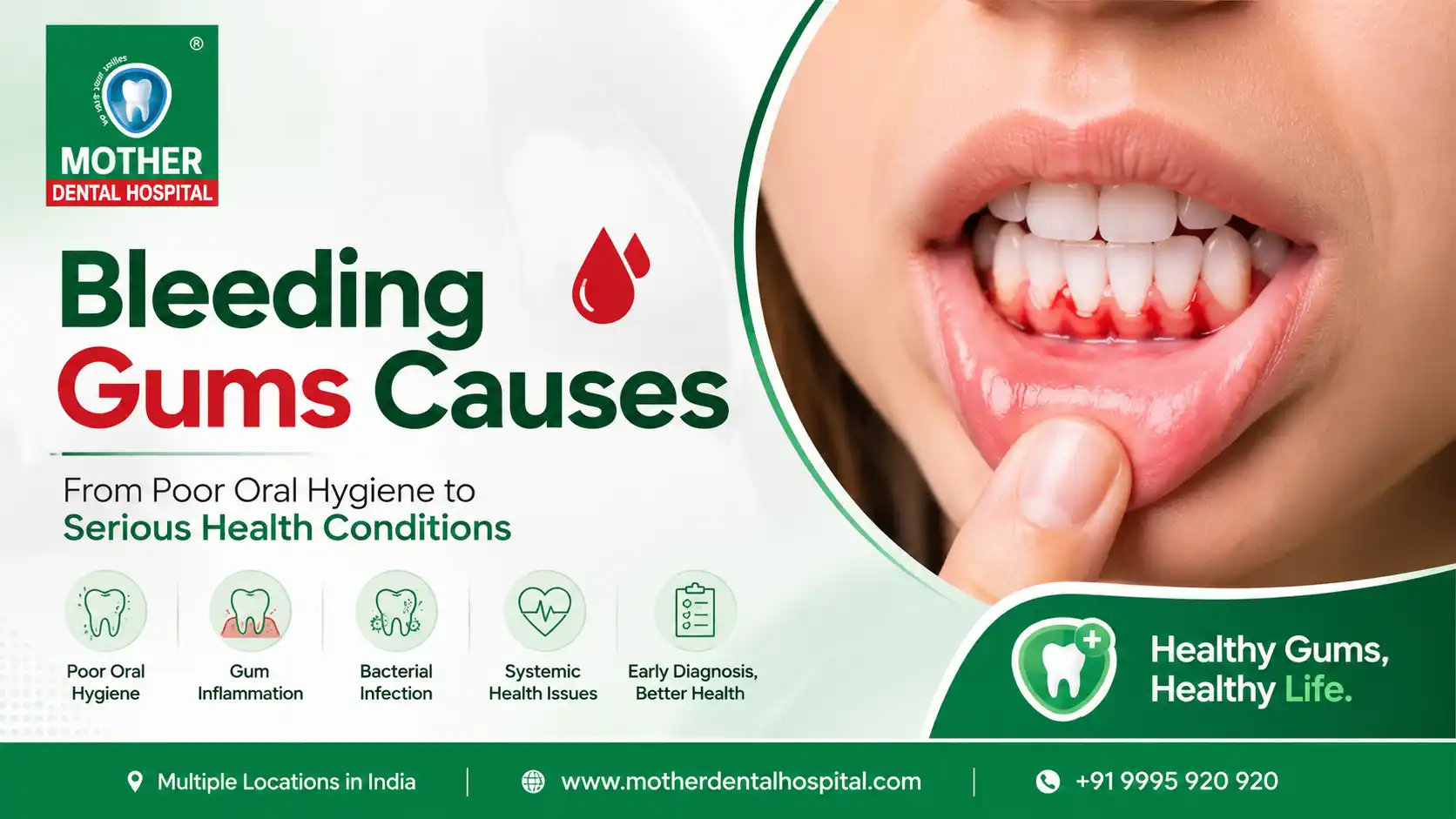 Bleeding Gums Causes